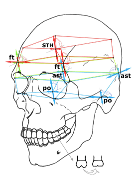 図５．第１大臼歯の磨り減り程度と共変動する頭蓋計測点近傍の３次元構造偏倚