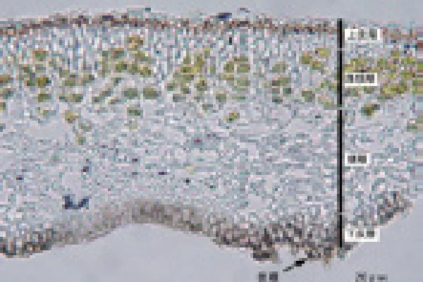 地衣類‗顕微鏡写真