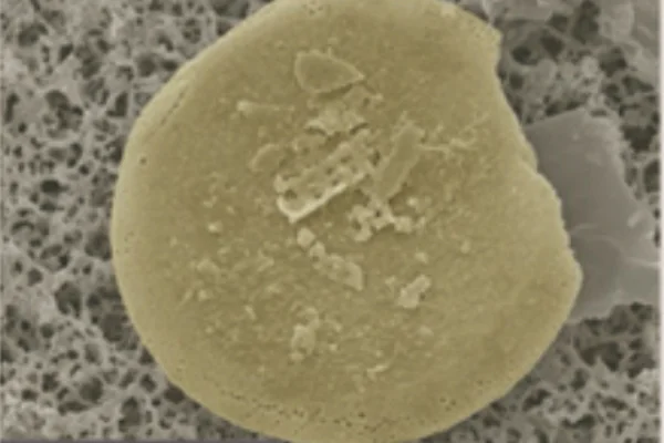 淡水アクチノキクルス属