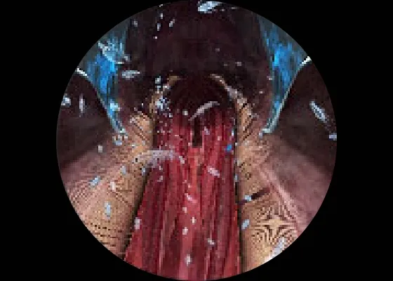 Scene 2 マイワシの口と鰓耙（さいは）とコペポーダ