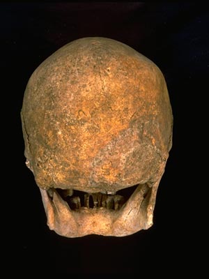 Posterior