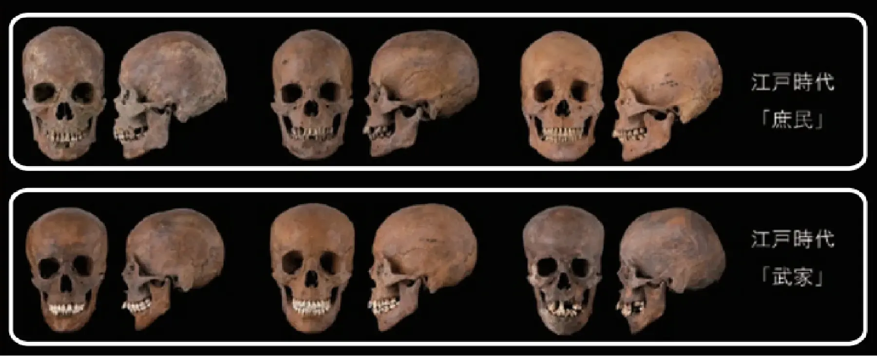 庶民と武家の頭蓋