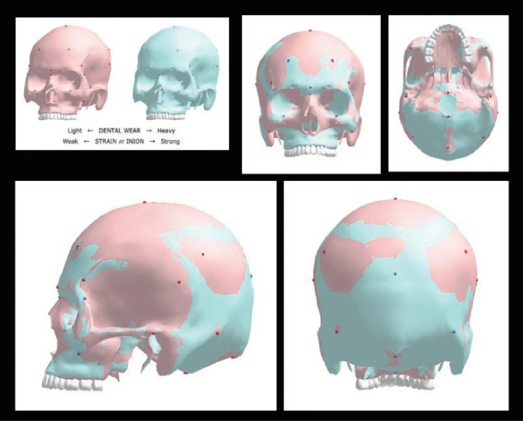 頭骨の三次元的重ね合わせ図