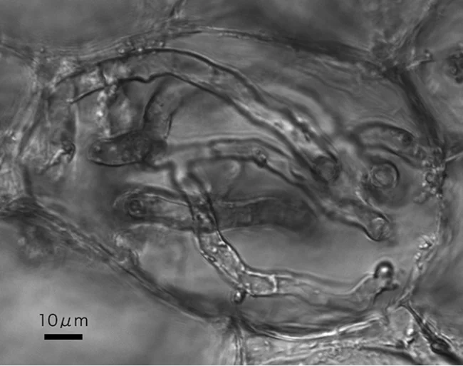 ヤクシマラン亜科の根に共生する菌