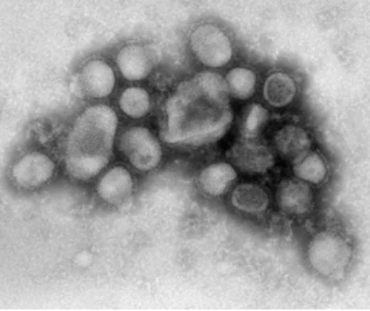 新型インフルエンザウイルス