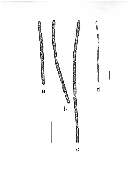 Pseudanabaena foetida