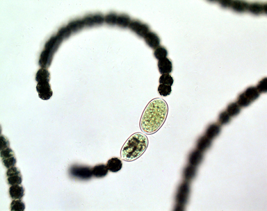 Dolichospermum circinale