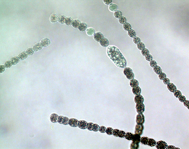 Dolichospermum circinale