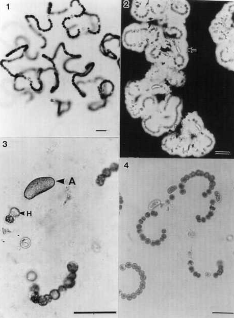 Dolichospermum curvum