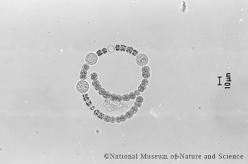 Dolichospermum mucosum