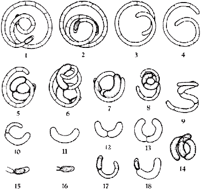 Raphidiopsis curvispora