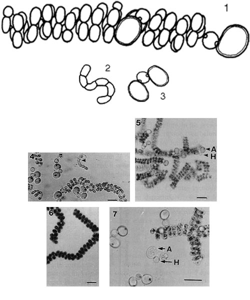 Sphaerospermopsis eucompacta