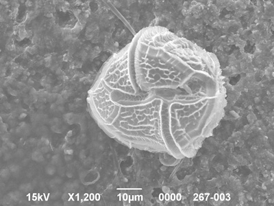 <i>Peridinium bipes f. occultatum</i>