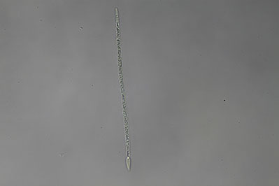 <i>Raphidiopsis raciborskii (Cylindrospermopsis raciborskii)</i>