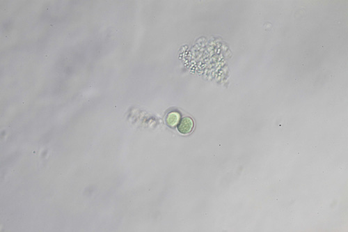 <i>Chroococcus minutus</i>