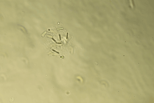 <i>Lemmermanniella flexa</i>