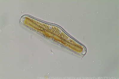 <i>Rhopalodia gibba</i>