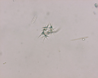 <i>Ankistrodesmus falcatus</i>
