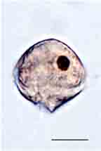 <i>Tyrannodinium edax</i>