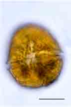 <i>Peridinium cinctum</i>