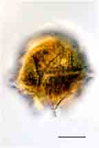 <i>Peridinium cinctum var. tuberosum</i>