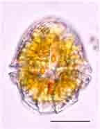 <i>Peridinium striolatum</i>