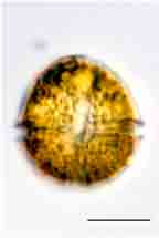 <i>Peridinium volzii</i>