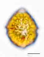 <i>Parvodinium lubienlense</i>