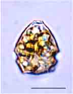 <i>Parvodinium umbonatum</i>