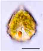<i>Peridiniopsis cunningtonii</i>