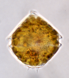 <i>Unruhdinium penardii</i>