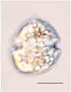 <i>Glochiodinium penartiforme</i>