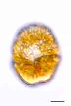 <i>Gymnodinium uberrimum</i>