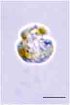 <i>Prosoaulax lacustris</i>