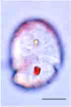 <i>Opisthoaulax woloszynskae</i>