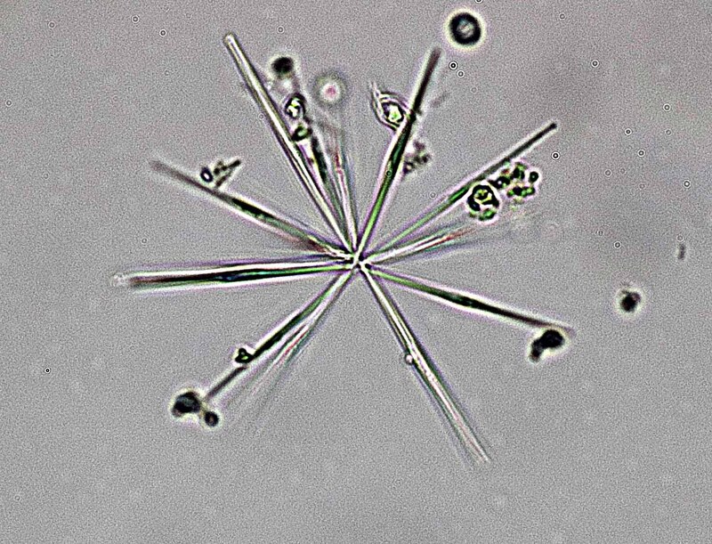 <i>Fragilaria asterionelloides</i>