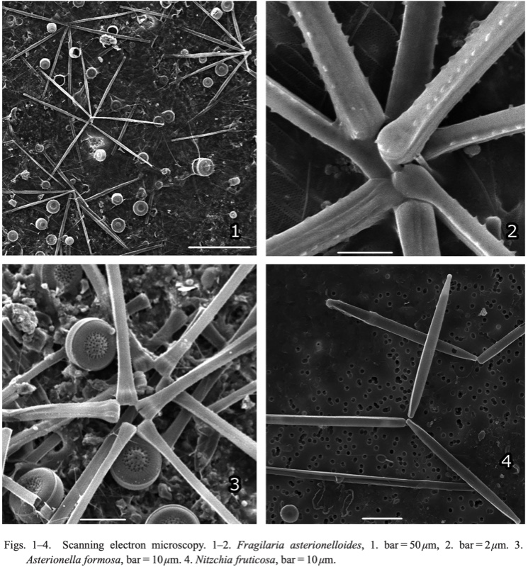<i>Fragilaria asterionelloides etc</i>