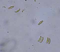 <i>Achnanthidium catenatum</i>