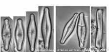 <i>Achnanthidium microcephalum</i>