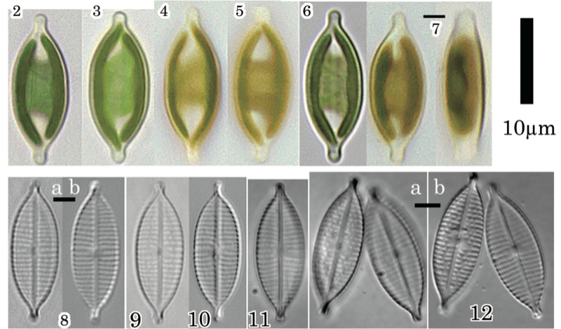 <i>Craticula pseudocitrus</i>