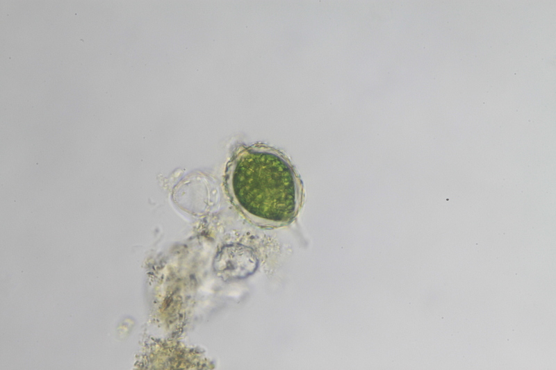 <i>Strombomonas sp.</i>