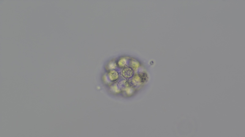 <i>Coelastrum pulchrum</i>