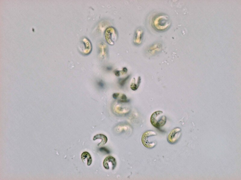 <i>Kirchneriella irregularis</i>