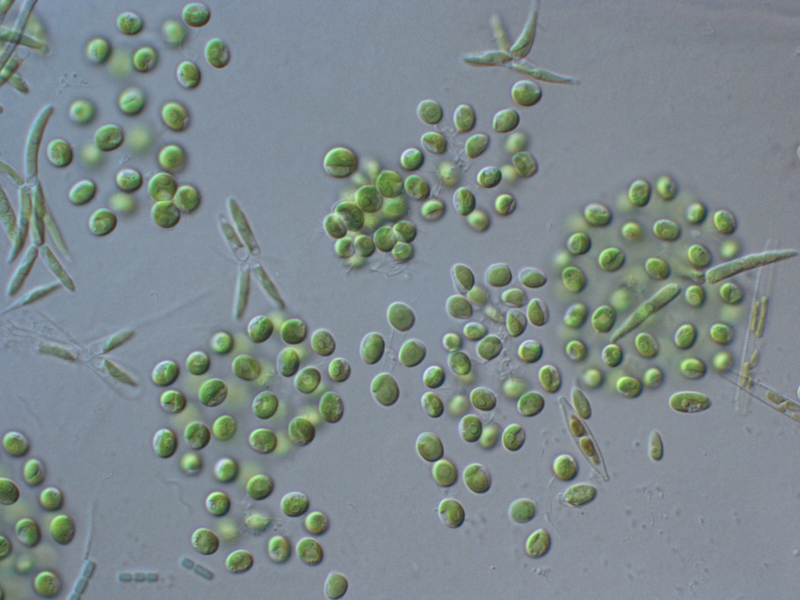 <i>Dictyosphaerium sp.</i>