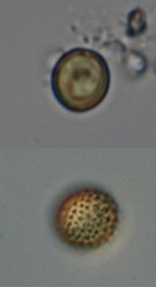 <i>Chrysococcus scp.</i>