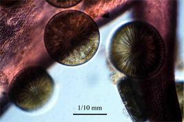 現生の着生珪藻「アラクノイディスクス」